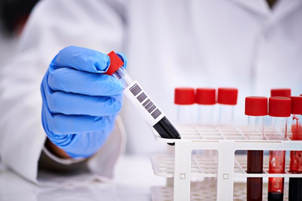 Ilustrație analize medicale de laborator